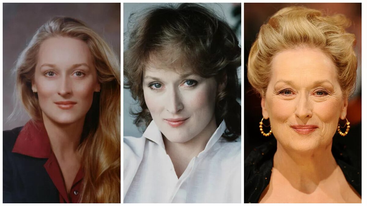 Мелкоморщинистый морфотип старения. Старение лица у женщины. Старость и старение. Морщинистый тип старения. Возрастные изменения кожи лица.