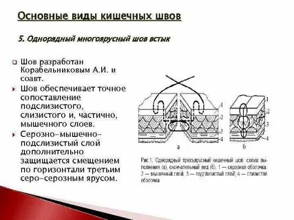 Кишечные швы топографическая анатомия