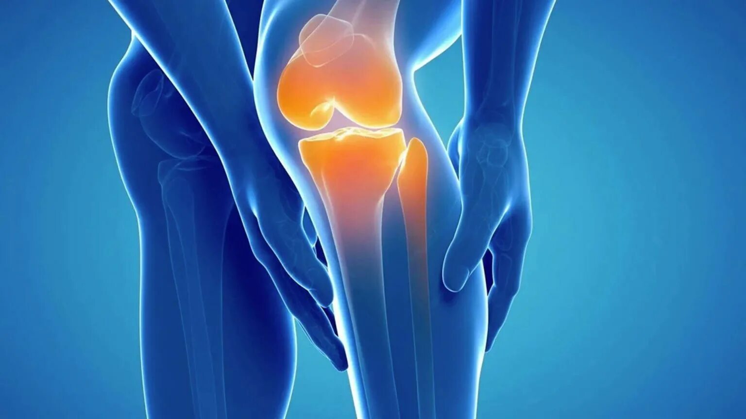 Эффективное лечение артроза сустава. Пателлофеморальный артроз коленного сустава рентген. Дисплазия пателлофеморального сустава колена. Здоровые суставы.