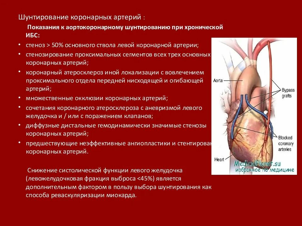 Ибс пикс