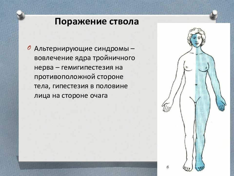 Инсульт левосторонний гемипарез. Монопарез гемипарез парапарез тетрапарез. Парез при ишемическом инсульте. Двойная гемиплегия очаг поражения. Поражение половины тела.