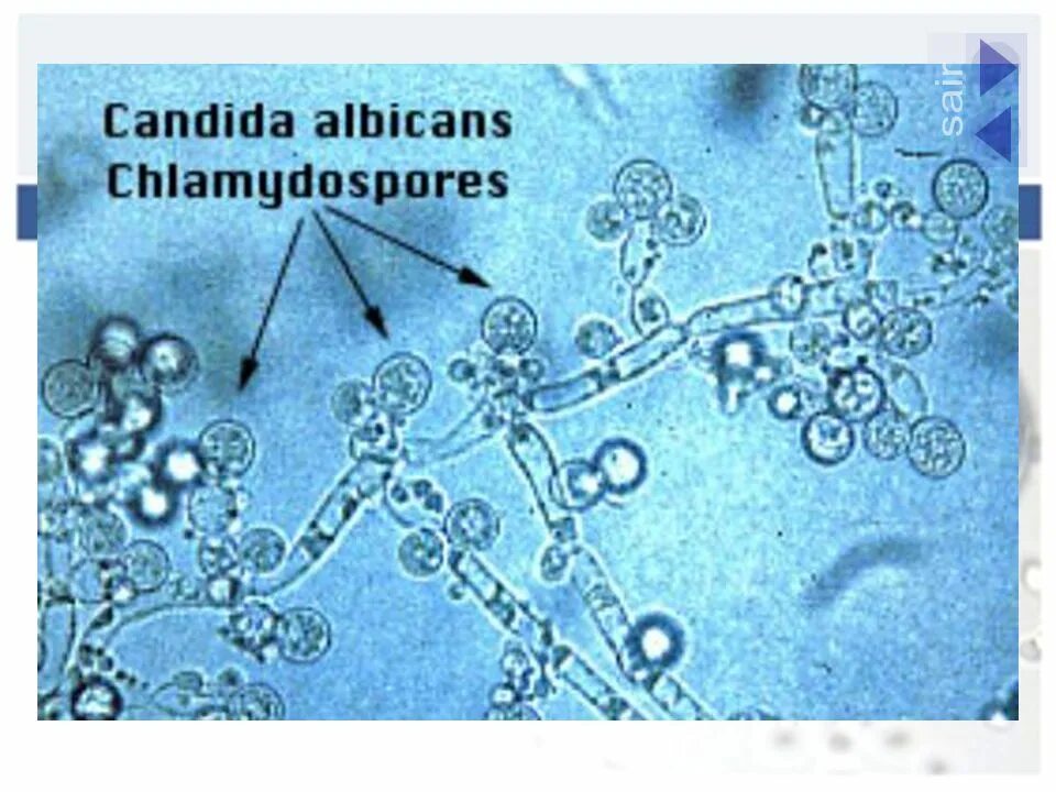 Кандида альбиканс под микроскопом. Дрожжеподобный гриб candida albicans. Грибы кандида микроскопия. Путь кандида. Грибы рода кандида строение.