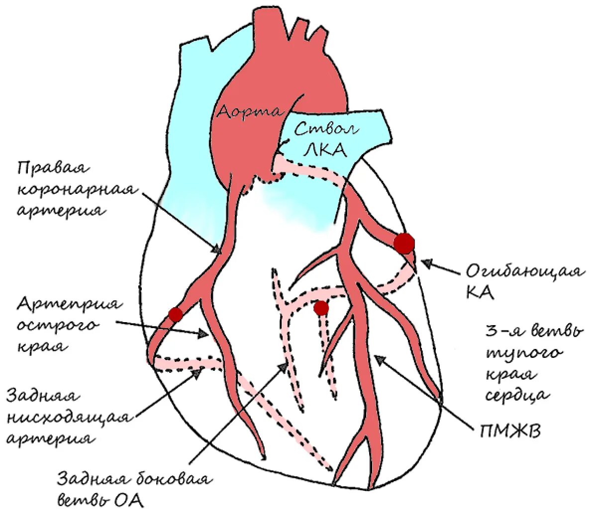 Коронарные артерии сердца схема. Коронарные сосуды сердца анатомия схема. Ствол левой коронарной артерии анатомия. Схема левой коронарной артерии.