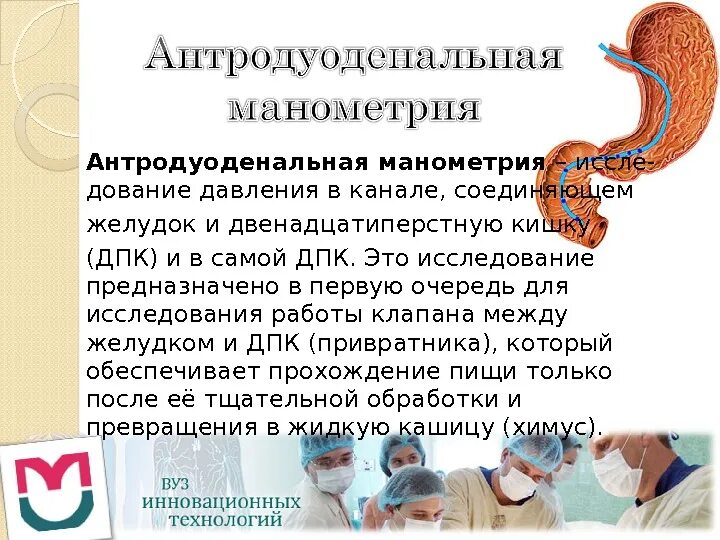 Манометрия высокого разрешения пищевода. Аноректальная манометрия. Эзофагеальная манометрия. Антродуоденальная манометрия. Пищеводная манометрия высокого разрешения.