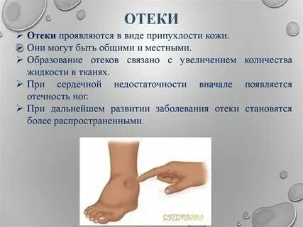 Что делать если отек