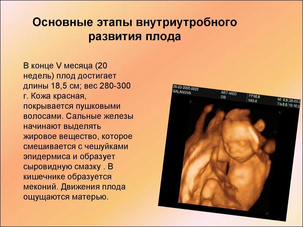 Шевеления плода ощущения. Шевеления плода норма на 20 неделе беременности норма. Шевеление плода 20 недель беременности норма. Шевеление плода на 20 неделе беременности. Какого размера ребенок на 18 неделе.