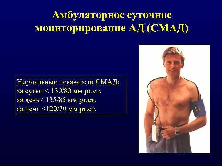 Новая услуга. Суточное мониторирование ЭКГ (холтеровское мониторирование)