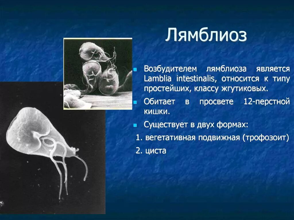 Паразит лямблия симптомы. Гиардиа лямблия. Лямблия вызывает заболевание. Возбудители протозойных кишечных инвазий лямблиоз. Инфекции вызванные простейшими