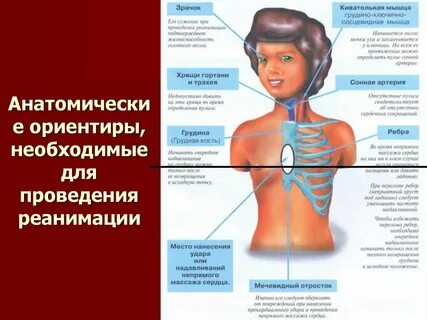 Массаж мечевидного отростка грудины