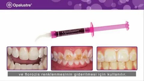 Микроабразия