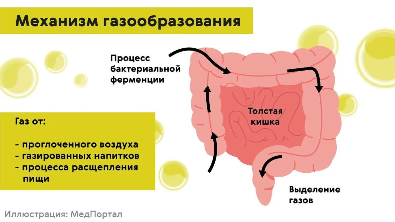 Почему вздутие и газы. Повышенное газообразование в кишечнике. газообразование в ободочной кишке. газообразование в кишечнике вздутие живота. вздутие кишечника и газообразование.