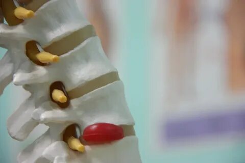 Сколько длится операция на грыжу поясничного отдела