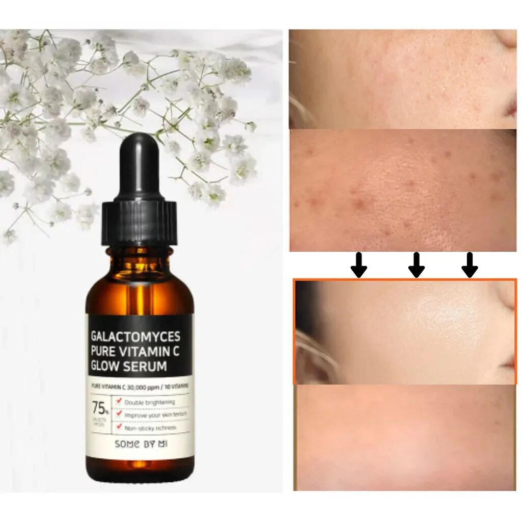 Galactomyces pure vitamin. Some by mi Galactomyces Pure Vitamin c. Some by mi Galactomyces Pure Vitamin c Glow Serum. Some by mi сыворотка. Glow Serum Vitamin c какого цвета должен быть серум во флаконе.