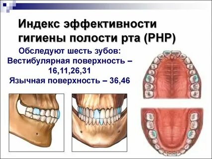 Индекс эффективности гигиены полости рта