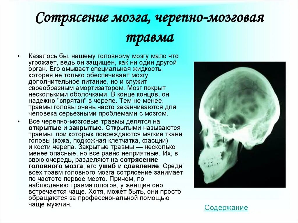 Сотрясение черепа. Повреждение черепа и мозга. Сотрясение головного мозга рентген. Рентген головы с сотрясением мозга.