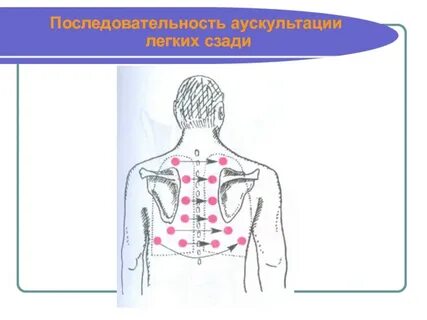 Бронхит аускультация