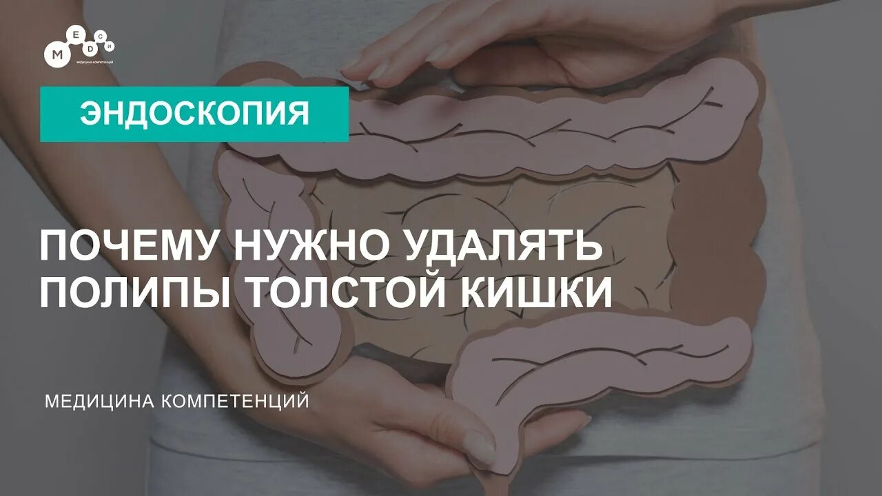 Диета полипэктомии. Удаление полипов в кишечнике. Удалить полип толстой кишки. Полипы при колоноскопии.