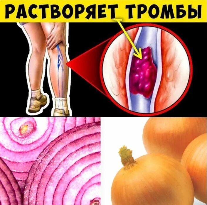 Продукты растворяющие тромбы. Продукты растворяющие тромбы в сосудах.