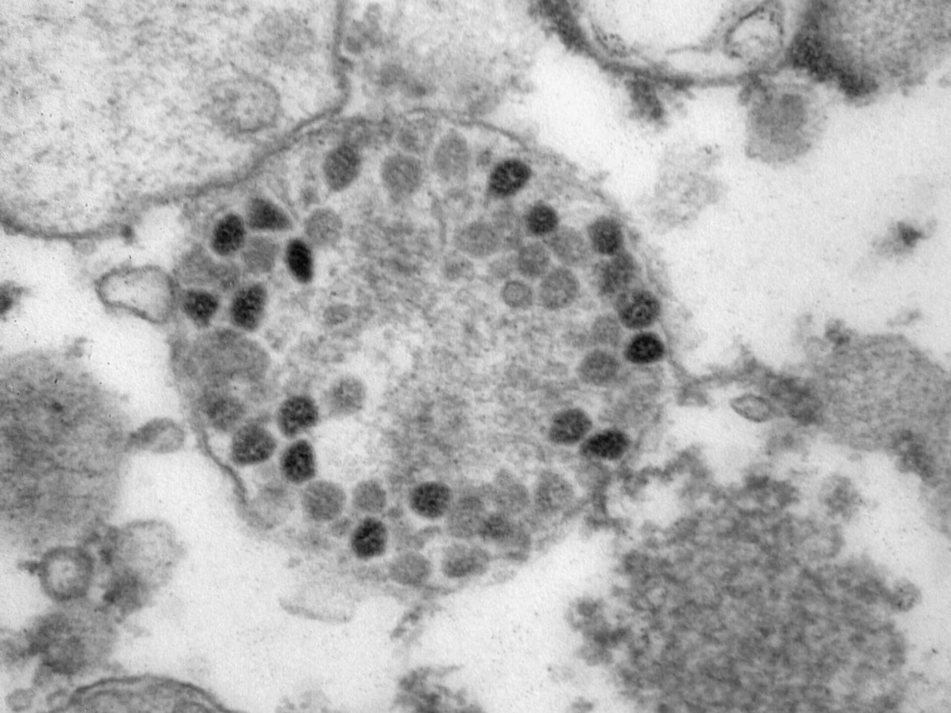Вирус Covid 19 под микроскопом. Омикрон-штамм SARS-cov-2. Коронавирус под микроскопом. Ковид Омикрон.