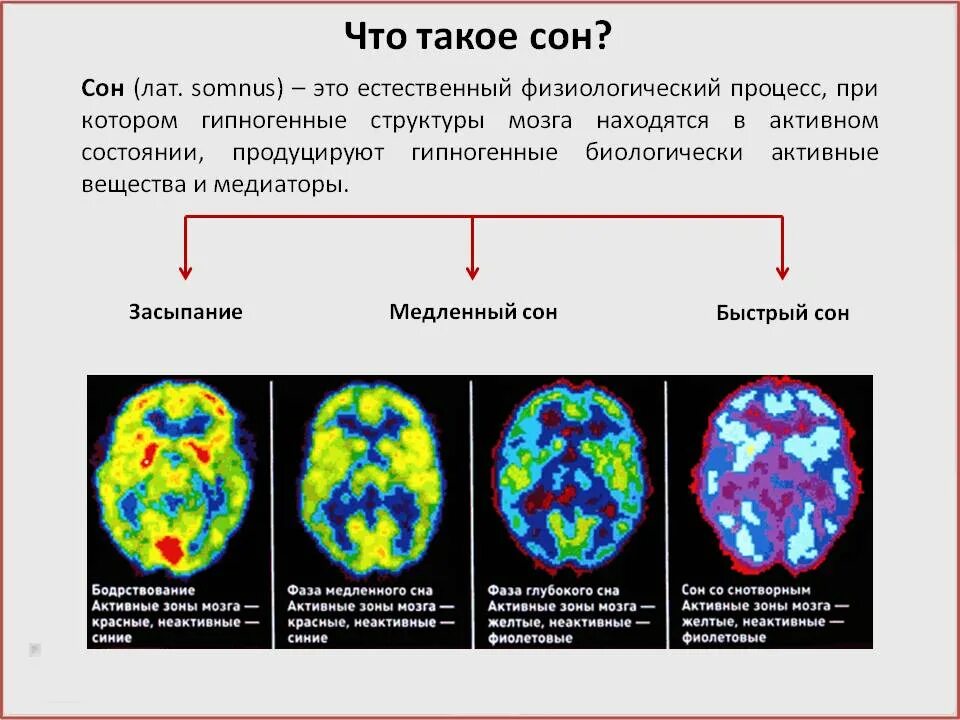 Физиологические процессы сна. Активность мозга во сне. Фазы активности мозга. Сон это физиологический процесс. Физиологическое состояние сна.