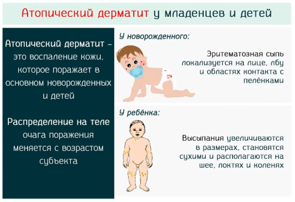 Развитие реакции у ребенка. Атопический дерматит причины у ребенка 1 год. как лечит дерматит у 7 месячного ребенка. атопический дерматит у ребенка 1 год 5 месяцев. эпический дерматит что такое у детей.