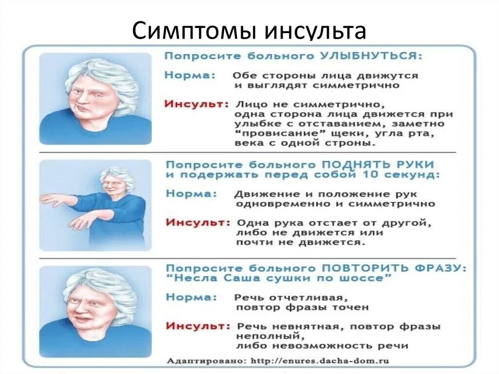 Инсульт холодно. Инсульт симптомы. Проявления инсульта. Симптомы при инсульте. Кожные покровы при инсульте.