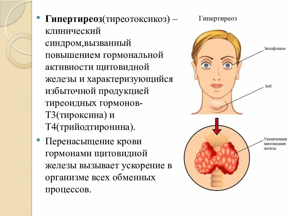 Заболевание при недостатке тироксина. Гипертиреоз щитовидной железы. Гиперфункция щитовидной железы симптомы. Заболевания щитовидной железы (гипертиреоз, тиреотоксикоз).. Гипертиреоз щитовидной железы симптомы.