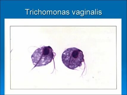 Trichomonas vaginālis