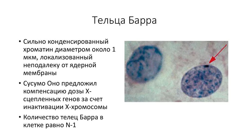 Тельца Барра в нейтрофилах. Таблица половой хроматин тельце Барра. Тельце Барра эухроматин. Тельце Барра в клетках буккального эпителия.