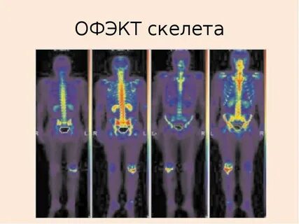 Кт скелета