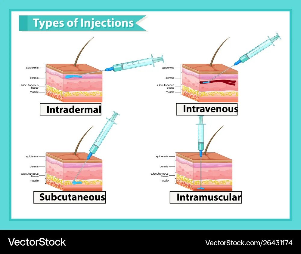 Inject mock
