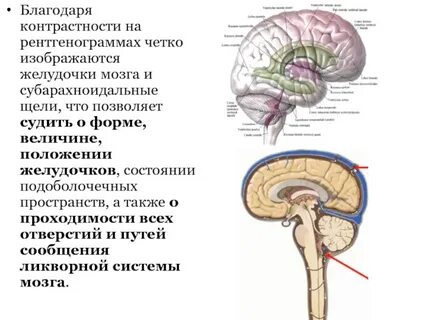 Субарахноидальное пространство выражено неравномерно