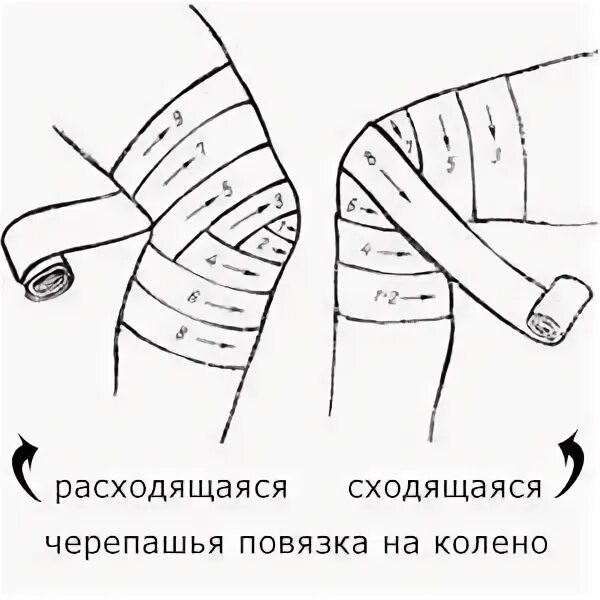 Черепашья повязка на коленный сустав расходящаяся. Бинтование колена эластичным бинтом. Схема бинтования колена эластичным бинтом. Черепашья повязка на коленный сустав. Как перевязывать колено