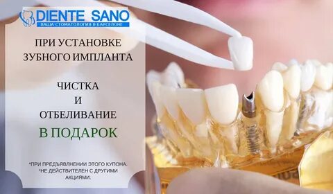 Чистка имплантов