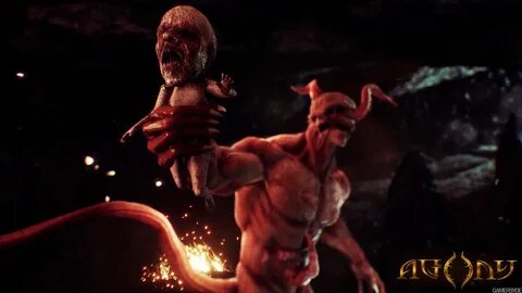 Agony pain