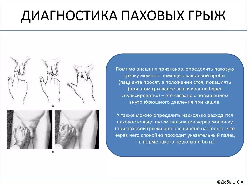 Сестринская помощь при грыжах живота - презентация онлайн
