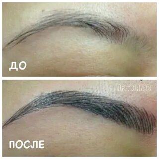 Волоски тень