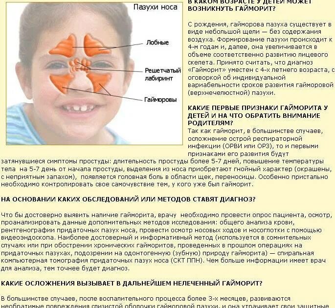 Гайморит сам проходит