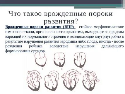 Врожденные пороки возникают