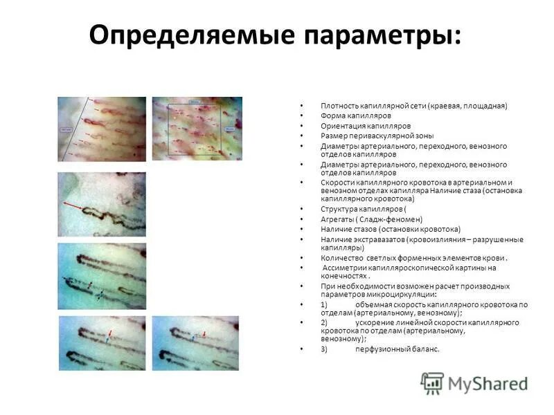 исследование капилляров