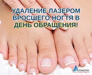 Лечение ногтей в москве