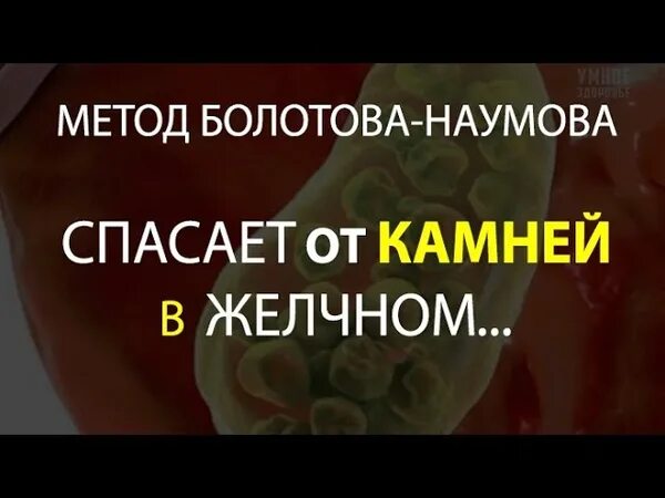 Ли растворить камни в желчном пузыре. Желчные камни растворение. Растворить камни в желчном пузыре. Растворитель камней в желчном пузыре. Продукты для растворения желчных камней.