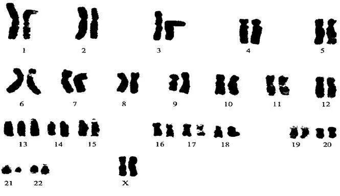 Синдром трисомии х кариотип. Кариотипирование синдром Орбели. Хромосомы у животных. Кариотип животных.