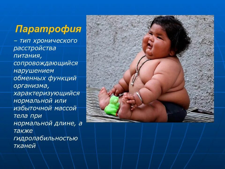 Хронические нарушения питания. Паратрофия. Паратрофия ожирение у детей. Расстройства питания у детей.