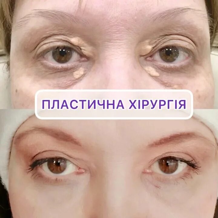 Центр блефаропластики