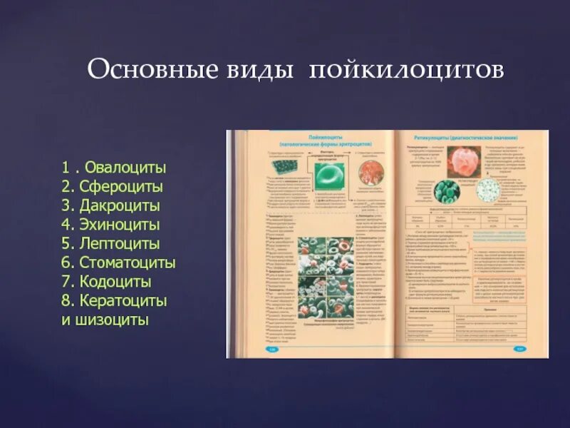 Эхиноциты. Лептоцит. Сфероциты овалоциты. Разновидности пойкилоцитов.