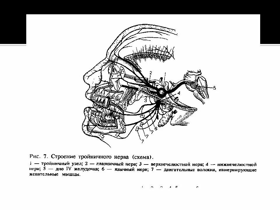 Тройничный нерв баня. Тройничный нерв схема 2 ветви. 3 ветвь тройничного нерва схема. тройничный нерв анатомия схема. двигательные волокна тройничного нерва.