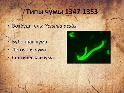 Типы чумы