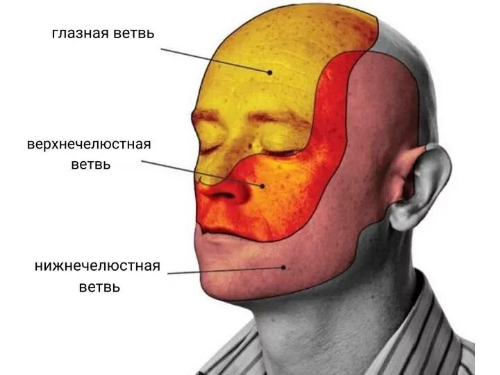 Болит голова. Точки пальпации тройничного нерва на лице. Боль на лице что это. Причины головной боли. Триггерные точки на лице.