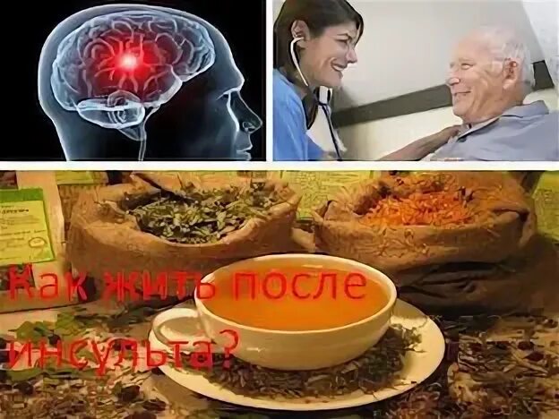Прогнозы после инсульта форум
